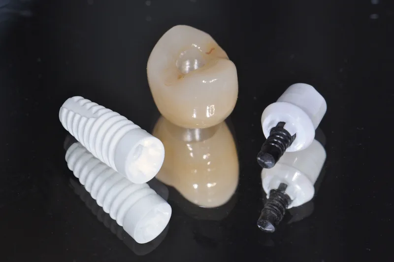 Zahnarzt Kilchberg Dr. Jens Tartsch - Dentist Kilchberg, Switzerland